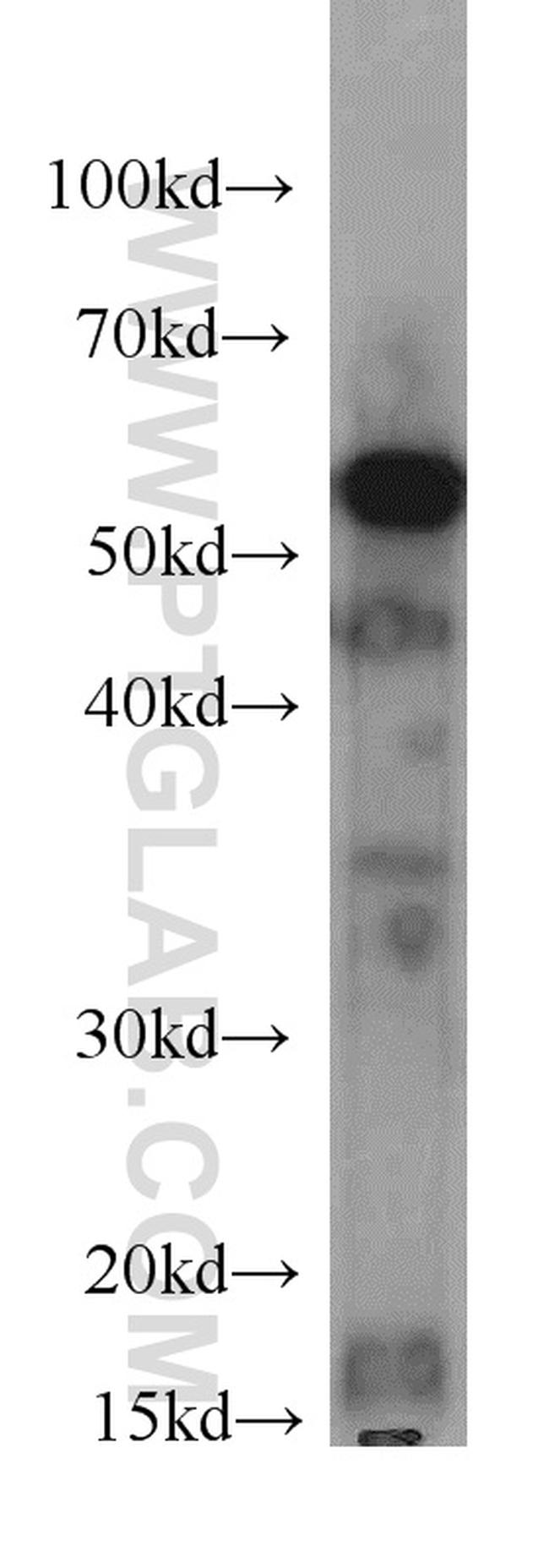 ATP5A1 Antibody in Western Blot (WB)