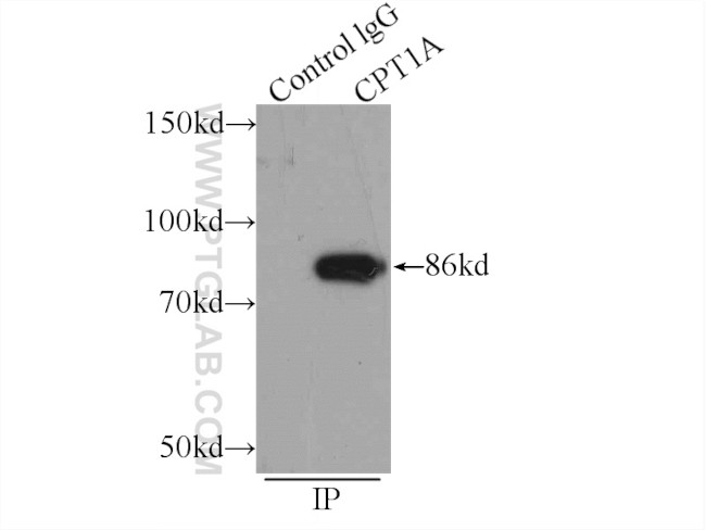 CPT1A Antibody in Immunoprecipitation (IP)