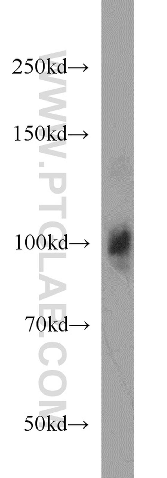 LONP1 Antibody in Western Blot (WB)