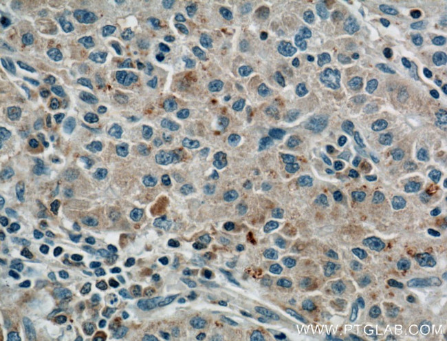 LPCAT1 Antibody in Immunohistochemistry (Paraffin) (IHC (P))