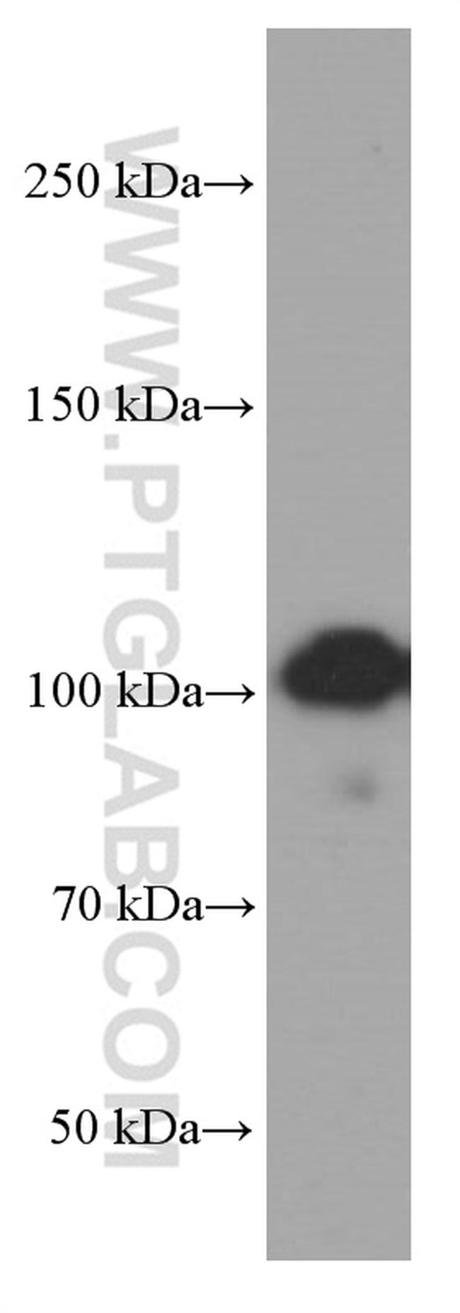 MMS19 Antibody in Western Blot (WB)