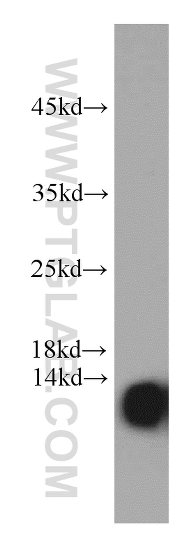 NDUFA4L2 Antibody in Western Blot (WB)