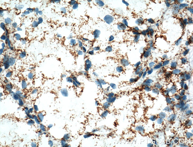 NDUFA4L2 Antibody in Immunohistochemistry (Paraffin) (IHC (P))