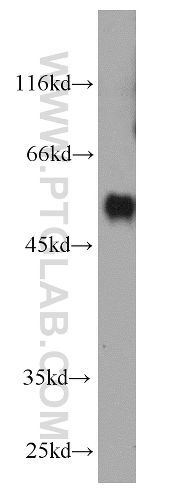 Antithrombin III Antibody in Western Blot (WB)