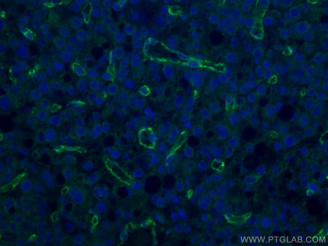 CD31 Antibody in Immunohistochemistry (Paraffin) (IHC (P))