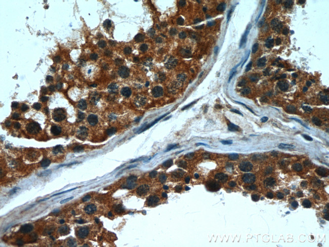 CPT1C Antibody in Immunohistochemistry (Paraffin) (IHC (P))