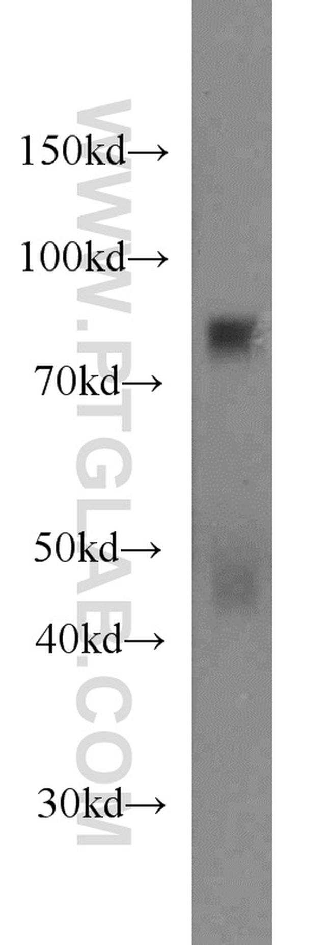 CPT1C Antibody in Western Blot (WB)