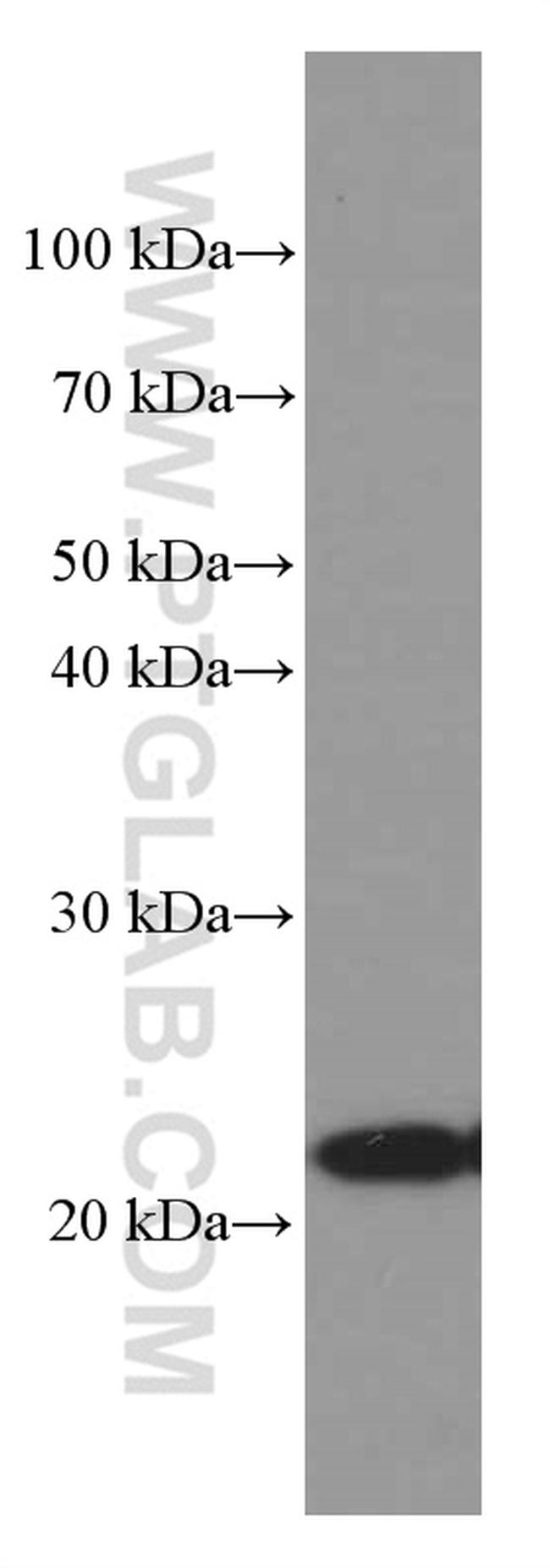 Phospho-TDP43 (Ser403, Ser404) Antibody in Western Blot (WB)