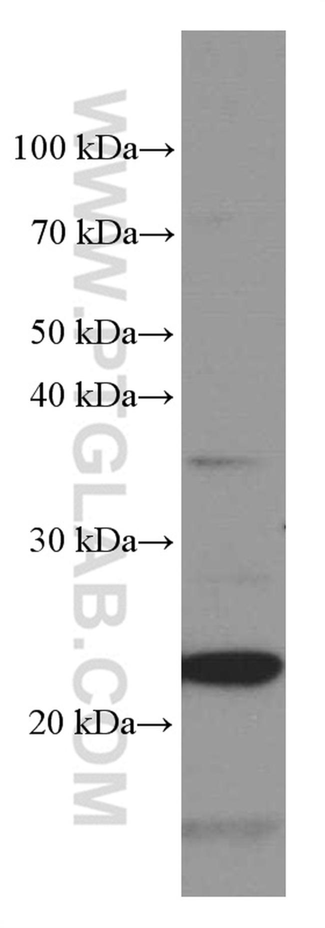 Phospho-TDP43 (Ser403, Ser404) Antibody in Western Blot (WB)