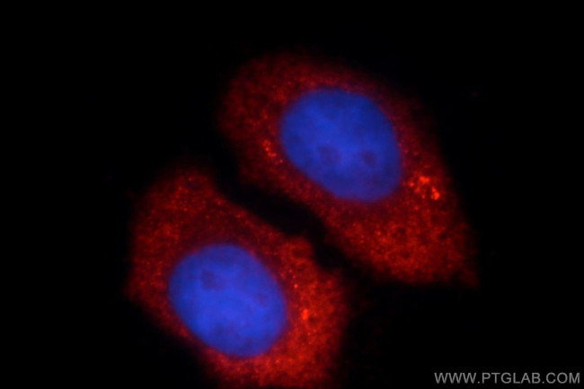 UBE2C Antibody in Immunocytochemistry (ICC/IF)