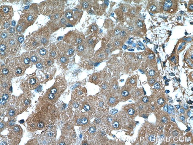 Factor XII Antibody in Immunohistochemistry (Paraffin) (IHC (P))