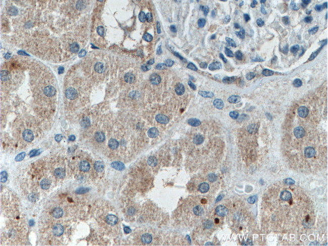 Melanophilin Antibody in Immunohistochemistry (Paraffin) (IHC (P))