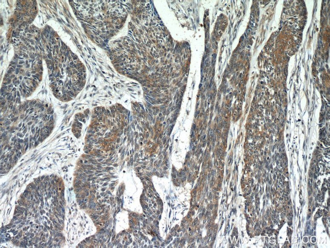 Melanophilin Antibody in Immunohistochemistry (Paraffin) (IHC (P))