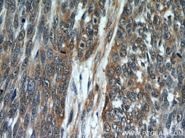 Melanophilin Antibody in Immunohistochemistry (Paraffin) (IHC (P))