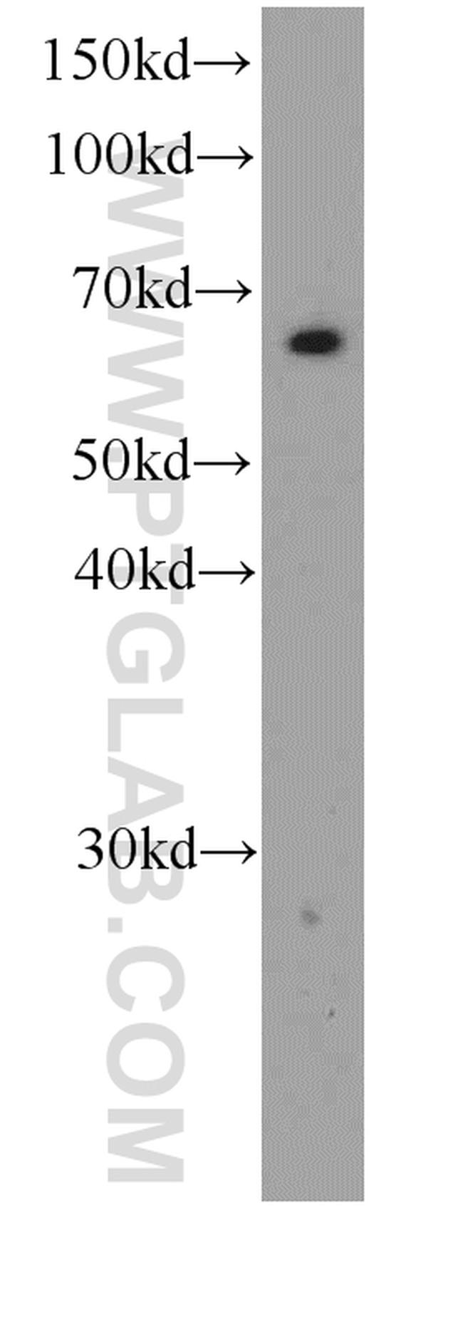 Melanophilin Antibody in Western Blot (WB)