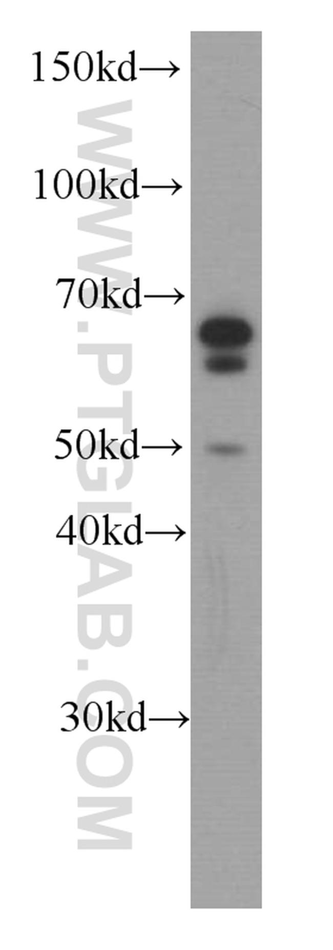 Melanophilin Antibody in Western Blot (WB)