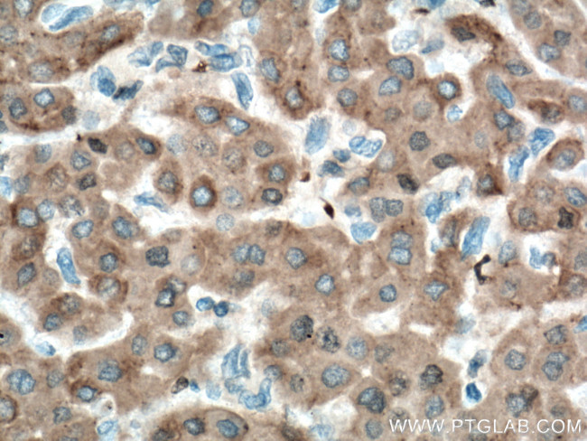 ORM1/2 Antibody in Immunohistochemistry (Paraffin) (IHC (P))