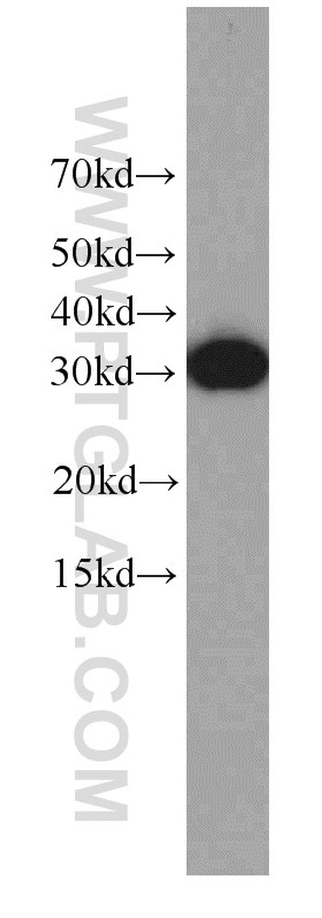 EXOSC2 Antibody in Western Blot (WB)