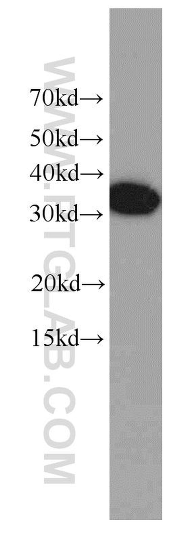 EXOSC2 Antibody in Western Blot (WB)