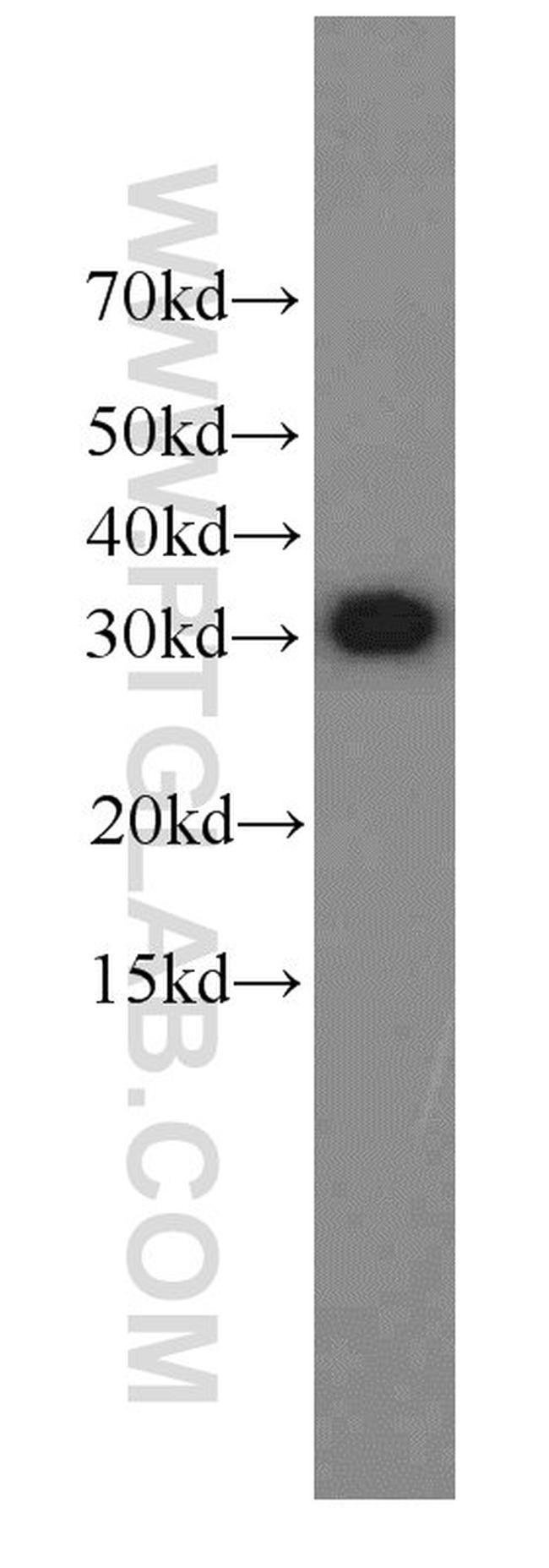 EXOSC2 Antibody in Western Blot (WB)