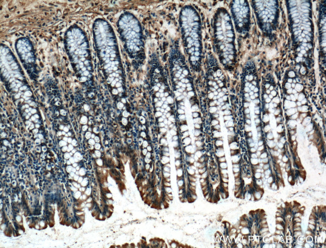 PGM1 Antibody in Immunohistochemistry (Paraffin) (IHC (P))