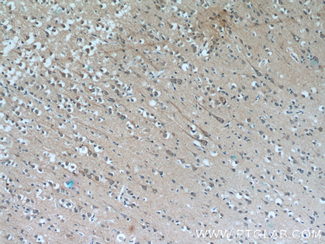 MAOB Antibody in Immunohistochemistry (Paraffin) (IHC (P))