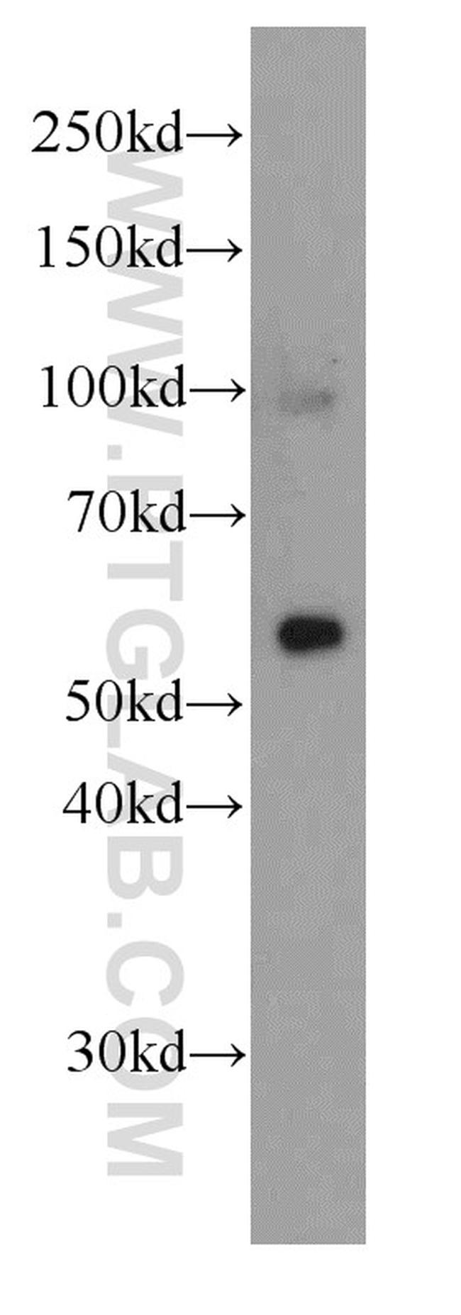 MAOB Antibody in Western Blot (WB)