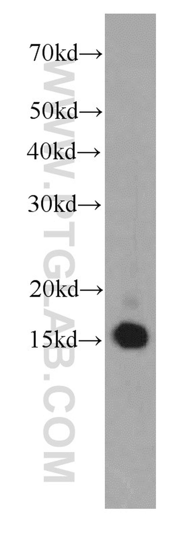 SNRPD2 Antibody in Western Blot (WB)
