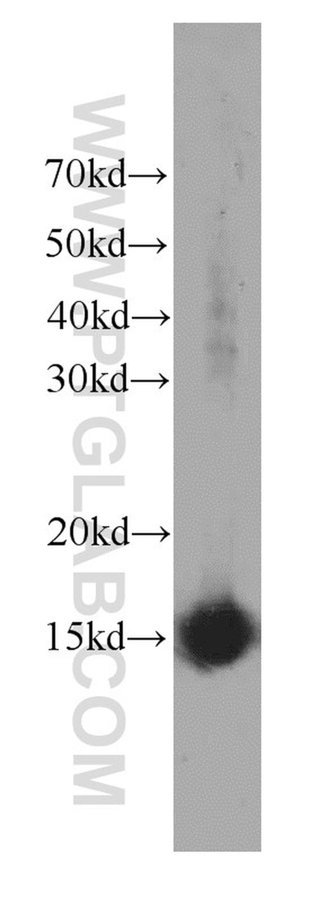 SNRPD2 Antibody in Western Blot (WB)