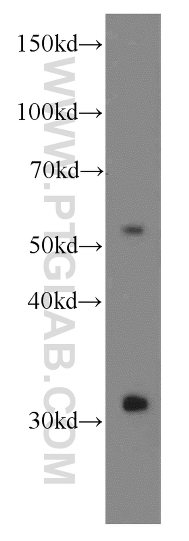 Iduronate 2 sulfatase Antibody in Western Blot (WB)