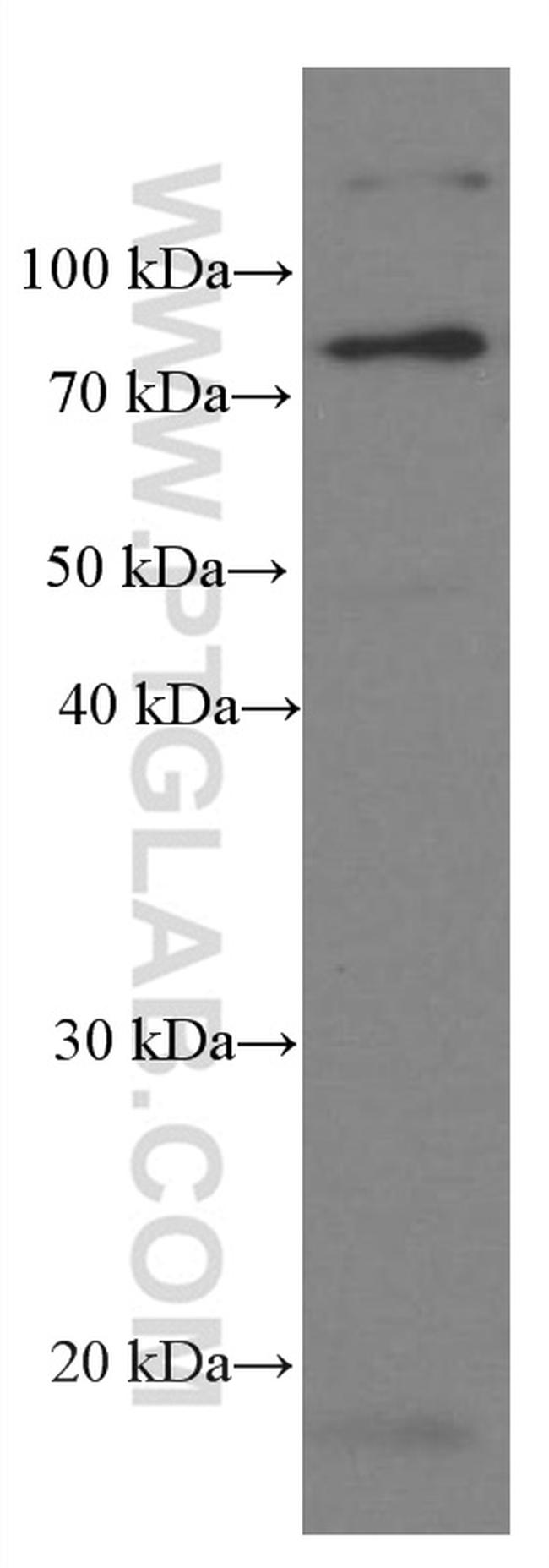 Iduronate 2 sulfatase Antibody in Western Blot (WB)