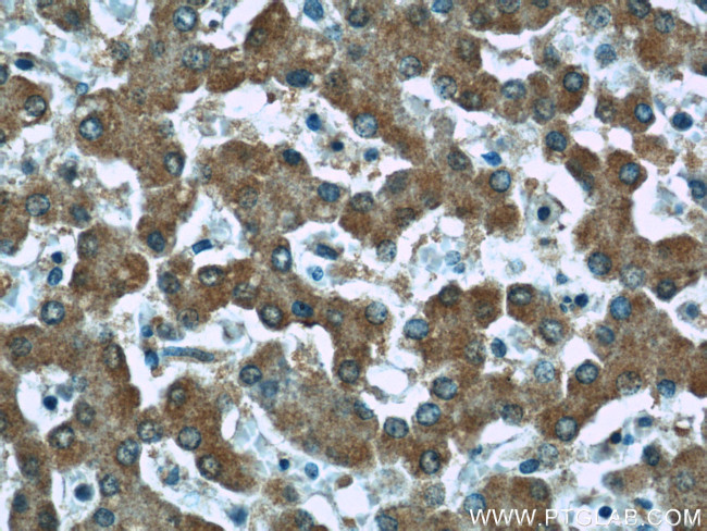 AFM Antibody in Immunohistochemistry (Paraffin) (IHC (P))