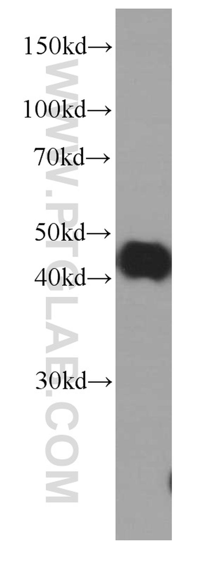 PDH E1 alpha Antibody in Western Blot (WB)