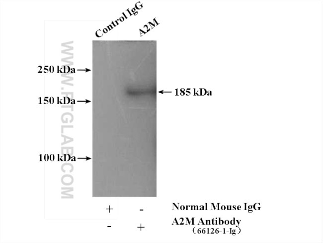 Alpha-2-macroglobulin Antibody in Immunoprecipitation (IP)