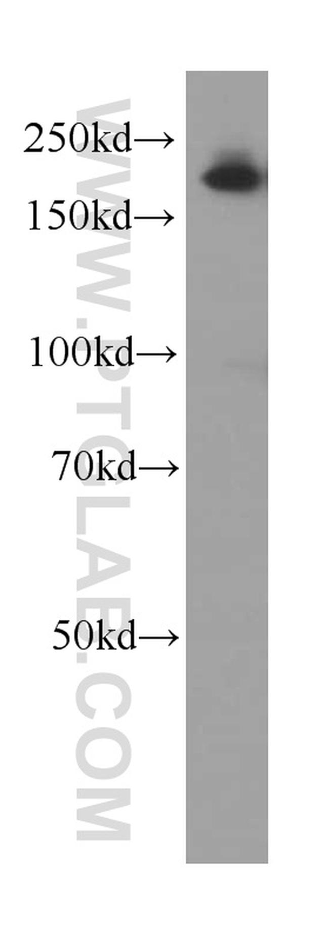 Alpha-2-macroglobulin Antibody in Western Blot (WB)