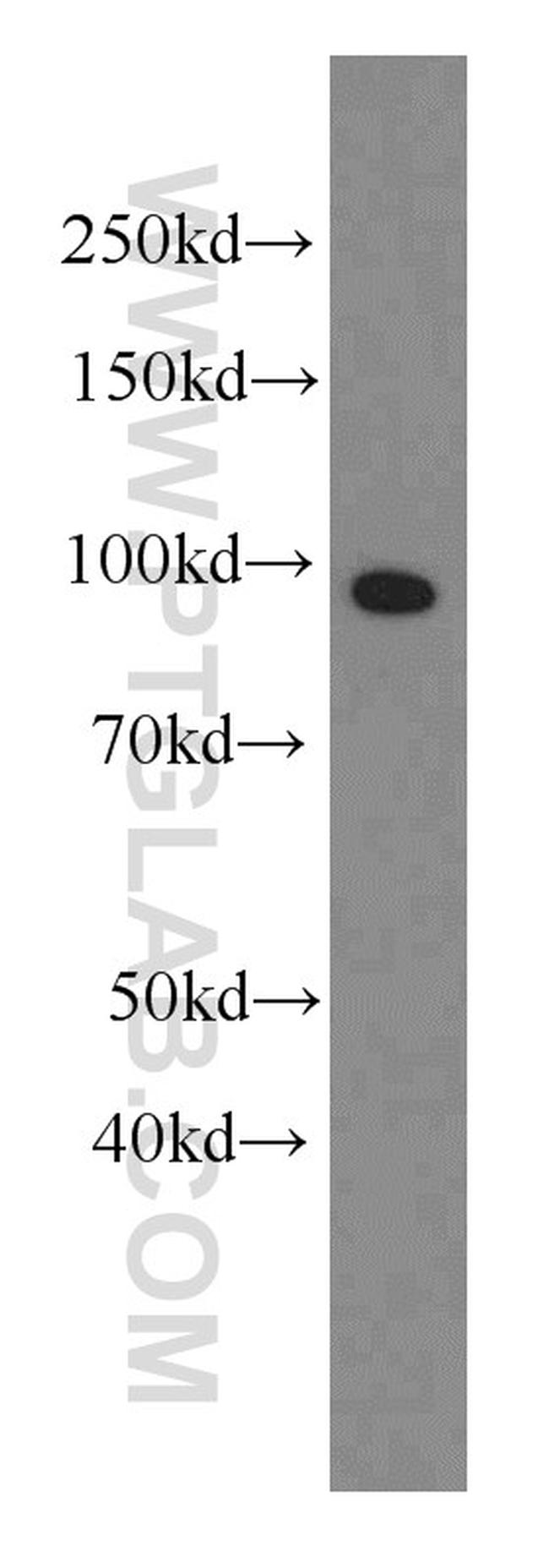 Complement factor B Antibody in Western Blot (WB)