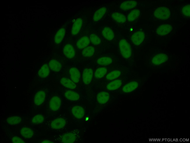 ANP32B Antibody in Immunocytochemistry (ICC/IF)