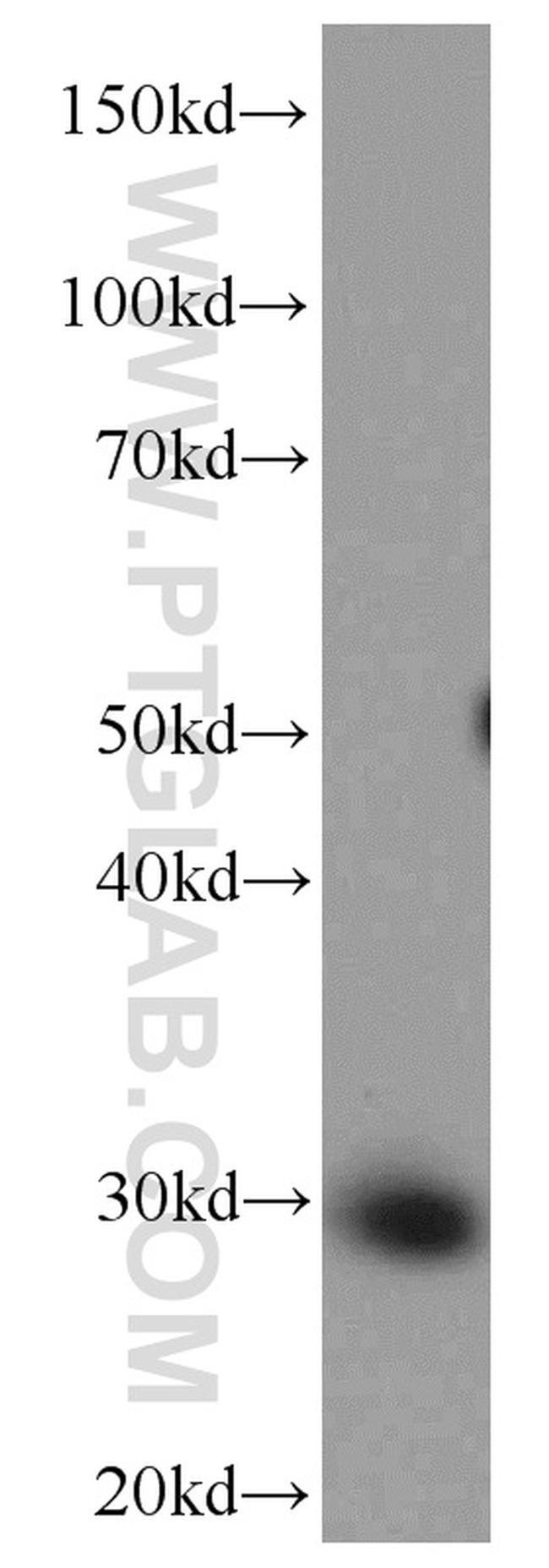 ANP32B Antibody in Western Blot (WB)