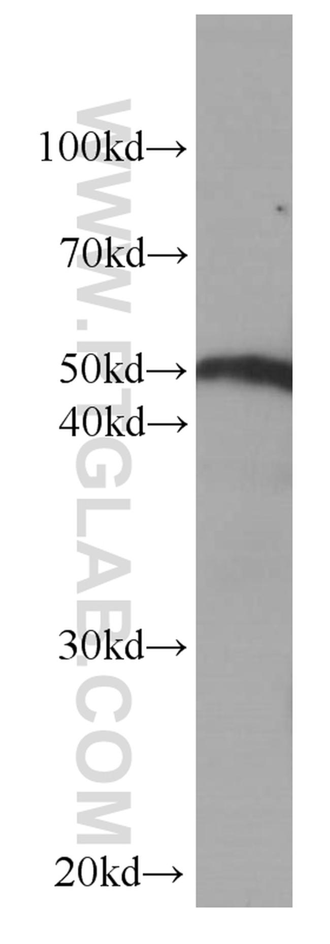 Fibrinogen beta chain Antibody in Western Blot (WB)