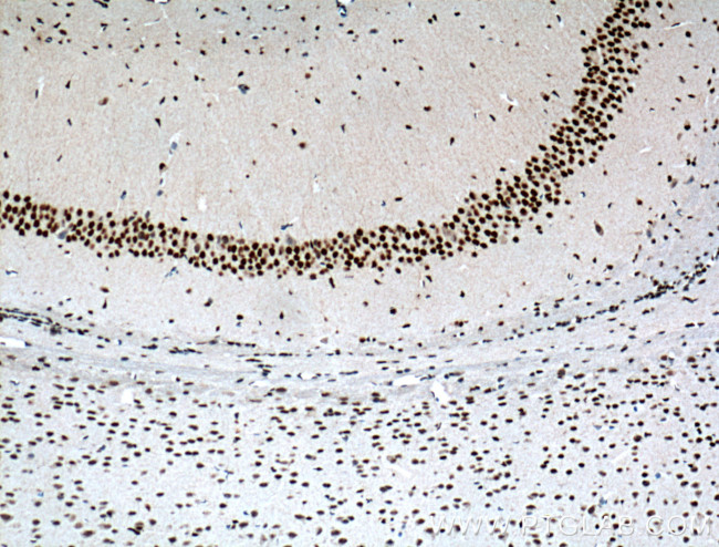 MTA2 Antibody in Immunohistochemistry (Paraffin) (IHC (P))