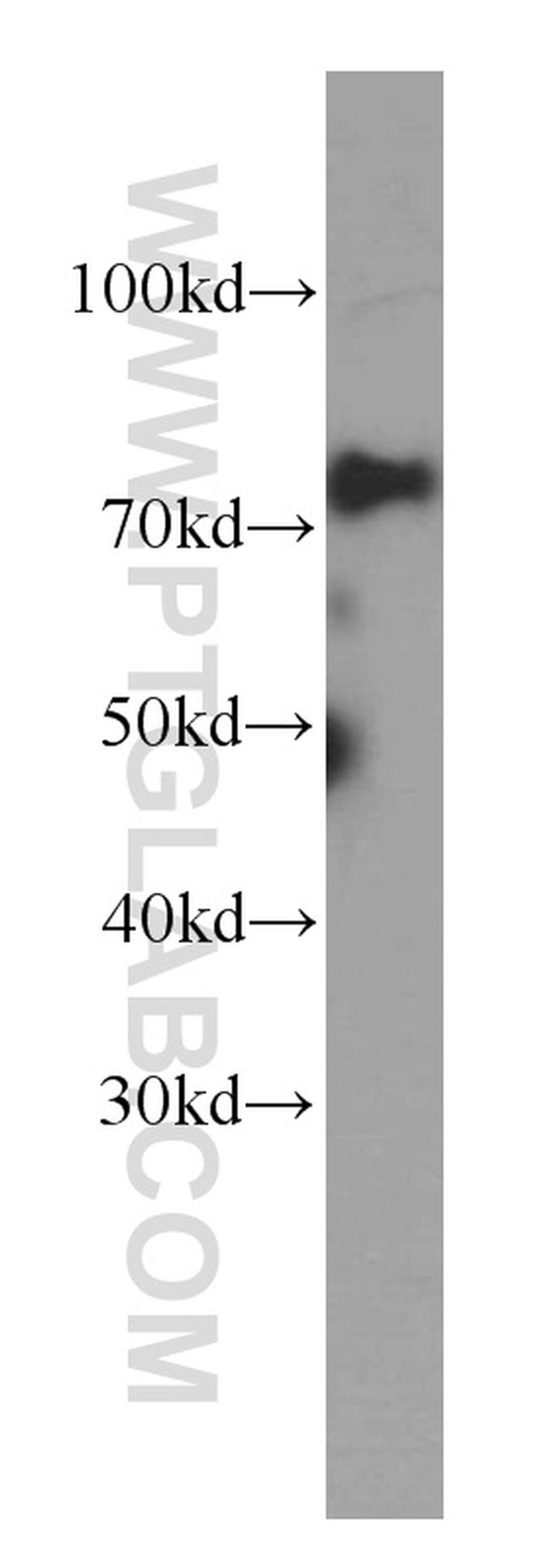 MTA2 Antibody in Western Blot (WB)