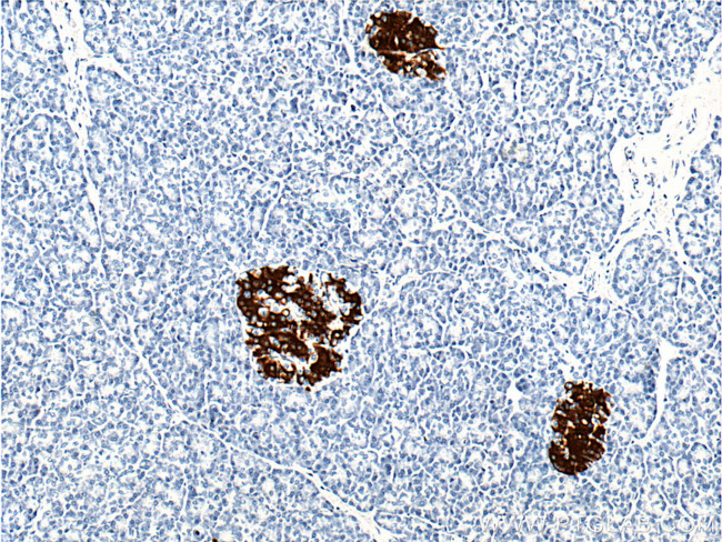 Insulin Antibody in Immunohistochemistry (Paraffin) (IHC (P))