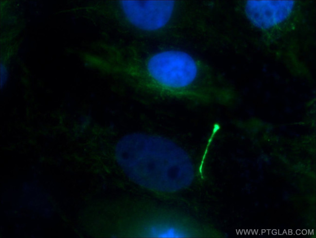 acetylated Tubulin(Lys40) Antibody in Immunocytochemistry (ICC/IF)