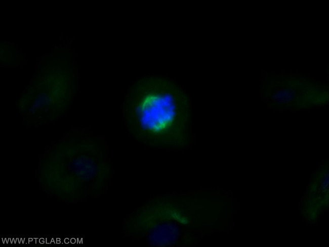 acetylated Tubulin(Lys40) Antibody in Immunocytochemistry (ICC/IF)