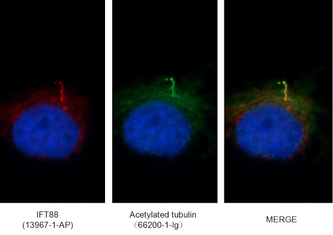 acetylated Tubulin(Lys40) Antibody in Immunocytochemistry (ICC/IF)