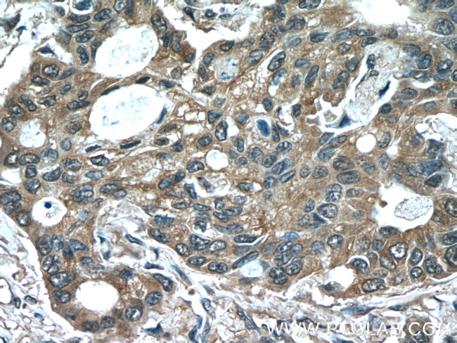 acetylated Tubulin(Lys40) Antibody in Immunohistochemistry (Paraffin) (IHC (P))