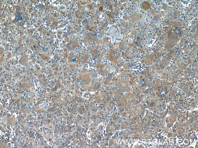 acetylated Tubulin(Lys40) Antibody in Immunohistochemistry (Paraffin) (IHC (P))