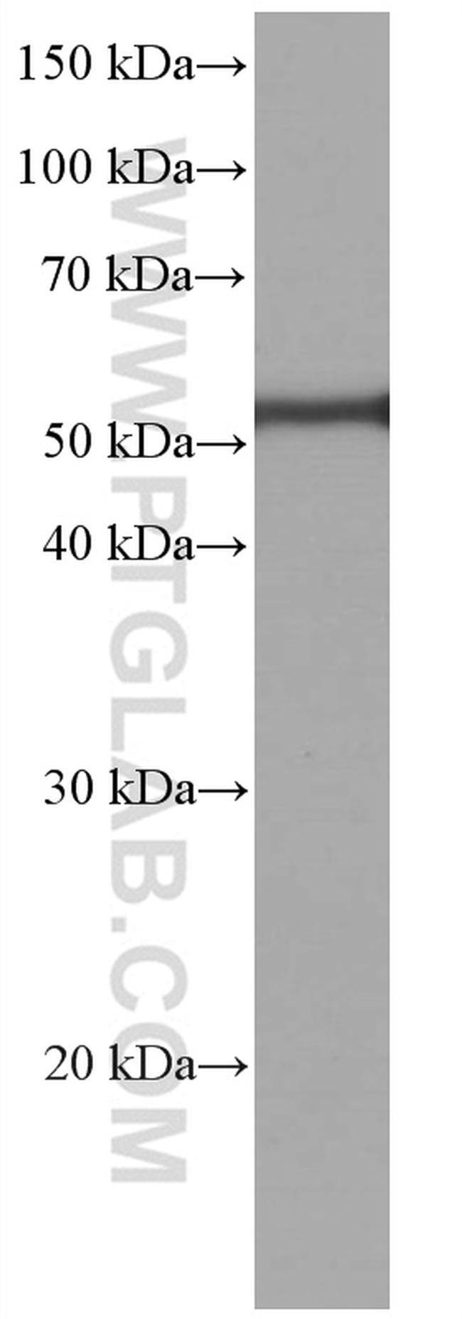 acetylated Tubulin(Lys40) Antibody in Western Blot (WB)