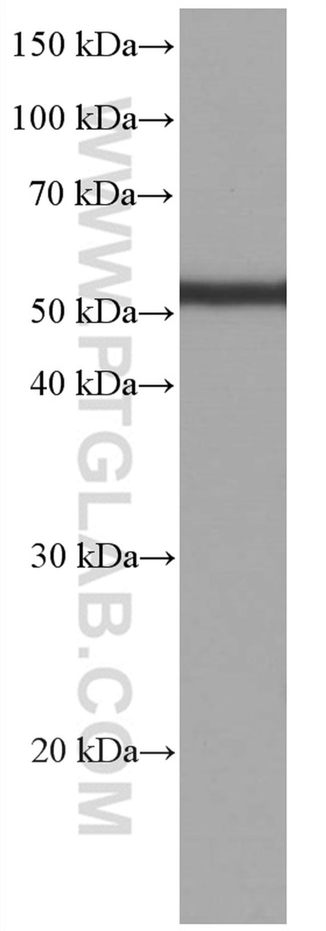 acetylated Tubulin(Lys40) Antibody in Western Blot (WB)