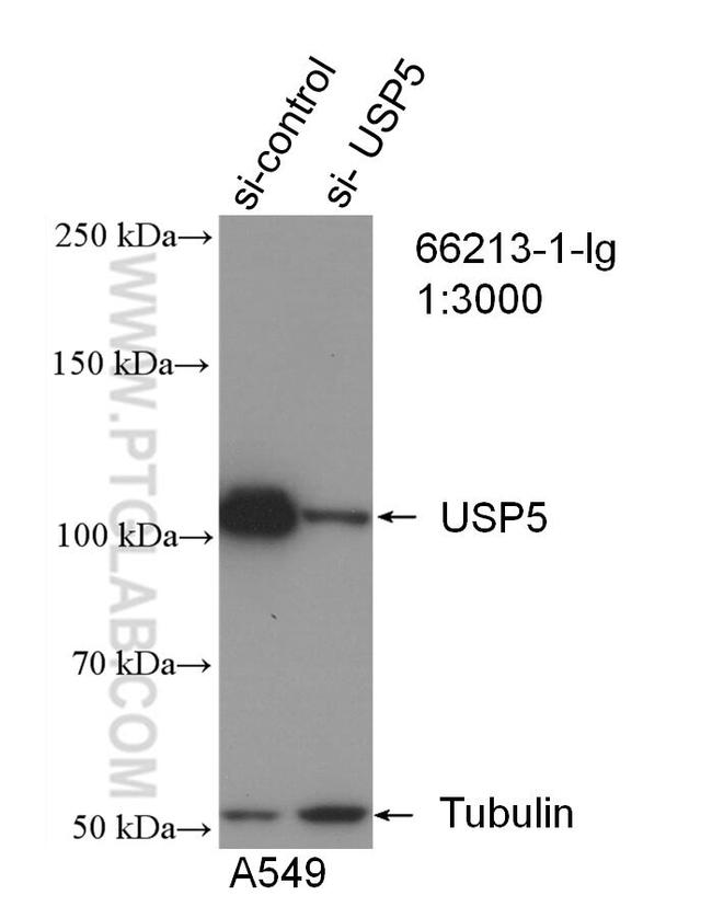 USP5 Antibody in Western Blot (WB)